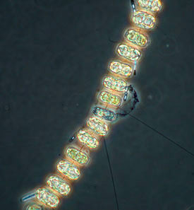 Thalassiosira diatom image from web source is http://cimt.ucsc.edu/habid/phytolist_diatoms/27thalassiosira.html